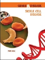 Sickle Cell Disease Sickle Cell Disease