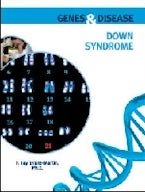 Down Syndrome Down Syndrome