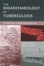 The Bioarchaeology of Tuberculosis The Bioarchaeology of Tuberculosis