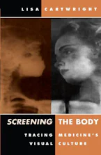 Cover of 'Screening the Body' 