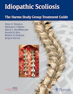 Cover of 'Idiopathic Scoliosis' 