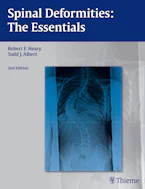 Cover of 'Spinal Deformities' 
