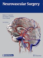 Neurovascular Surgery
