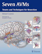 Cover of 'Seven AVMs' 