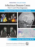 Infectious Disease Cases: Part 1: Can’t Miss Diagnoses