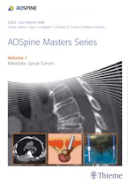 AOSpine Masters Series Volume 1: Metastatic Spinal Tumors