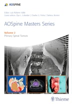 AOSpine Masters Series Volume 2: Primary Spinal Tumors