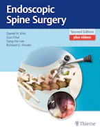 Cover of 'Endoscopic Spine Surgery' 
