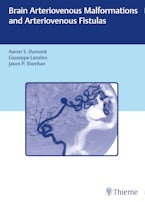 Brain Arteriovenous Malformations and Arteriovenous Fistulas