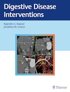 Digestive Disease Interventions