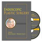 Cover of 'Endoscopic Plastic Surgery' 