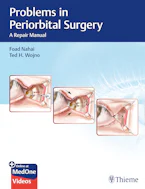 Cover of 'Problems in Periorbital Surgery' 