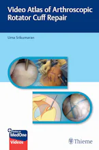 Cover of 'Video Atlas of Arthroscopic Rotator Cuff Repair' 