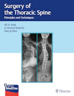 Cover of 'Surgery of the Thoracic Spine' 