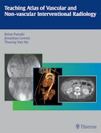 Teaching Atlas of Vascular and Non-vascular Interventional Radiology