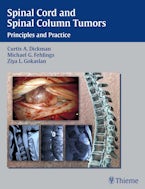 Spinal Cord and Spinal Column Tumors