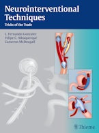 Neurointerventional Techniques