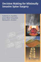 Cover of 'Decision Making for Minimally Invasive Spine Surgery' 