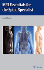 Cover of 'MRI Essentials for the Spine Specialist' 
