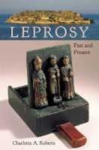 Leprosy Leprosy