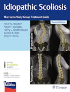 Cover of 'Idiopathic Scoliosis' 