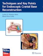 Techniques and Key Points for Endoscopic Cranial Base Reconstruction