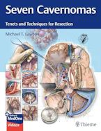 Cover of 'Seven Cavernomas' 