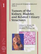 Cover of 'Tumors of the Kidney, Bladder, and Related Urinary Structures' 