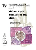 Melanocytic Tumors of the Skin Melanocytic Tumors of the Skin
