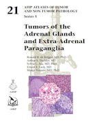 Tumors of the Adrenal Glands and Extra-Adrenal Paraganglia Tumors of the Adrenal Glands and Extra-Adrenal Paraganglia