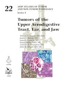 Tumors of the Upper Aerodigestive Tract, Ear, and Jaw
