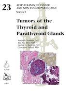 Tumors of the Thyroid and Parathyroid Glands