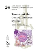 Tumors of the Central Nervous System Tumors of the Central Nervous System