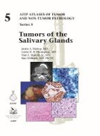 Tumors of the Salivary Glands Tumors of the Salivary Glands