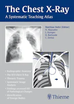 Cover of 'The Chest X-Ray' 