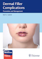 Cover of 'Dermal Filler Complications' 