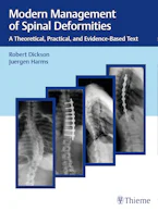 Cover of 'Modern Management of Spinal Deformities' 