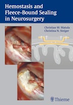 Hemostasis and Fleece-Bound Sealing in Neurosurgery