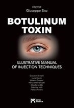 Botulinum Toxin Botulinum Toxin