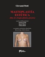 Mastoplastía Estética