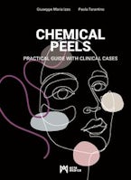 Chemical Peels Chemical Peels