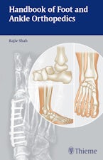 Handbook of Foot and Ankle Orthopedics