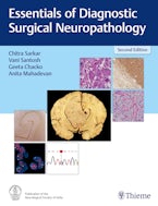 Essentials of Diagnostic Surgical Neuropathology