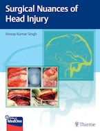 Surgical Nuances of Head Injury